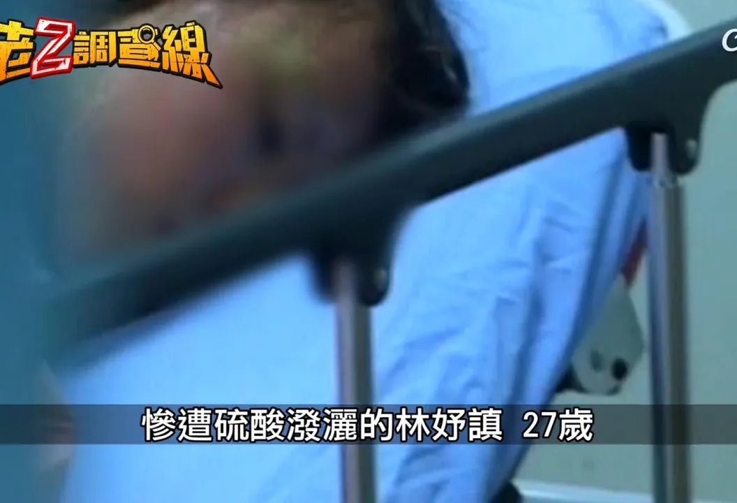 驚悚中山大學碩士潑酸案 求愛不成怒毀容美女學姊