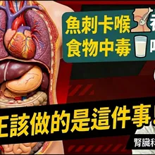 魚刺卡喉喝醋吞白飯? 誤食中毒物 喝牛奶?專家說都沒用 要立刻送醫!【#小麥的健康筆記】@中天電視CtiTv @健康我加1CtiHealthyme
