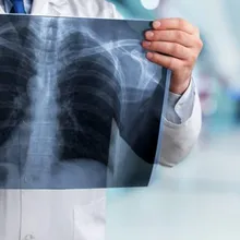 30歲台鐵駕駛驚見「肺部滿天星」 醫嘆:罹癌風險增1.5倍!