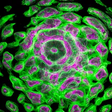 同基因有人罹癌有人沒事!醫:身體「代謝環境」是關鍵