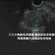 「胰臟癌」潛伏太兇！　醫示警：3種症狀別輕忽