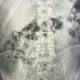 影/2波蘭男吞百顆海洛因入腹 闖關遭逮急送醫排出