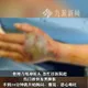 斷頭竟「跳起來咬人」!陸7旬翁斬眼鏡蛇頭遭咬 左手發黑險沒命