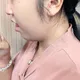 紓解公費肺癌篩檢瓶頸 彰基一站式服務提高量能