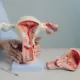 發生率暴增3倍!子宮內膜癌新療法納健保