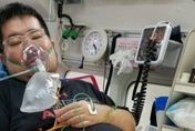 日本知名網紅「拓也哥」心衰竭病逝　生前因糖尿病惡化截肢