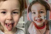 英國女童舌頭長「詭異黑點」　意外發現致命疾病！