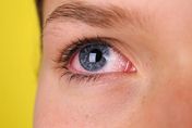 妙齡女眼睛長出紅色條狀物險失明！竟因戴隱形眼鏡「連續10年、每天10小時」