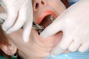 拔牙後高燒數月不退竟是患「心內膜炎」！醫曝做「這2手術」是高風險群