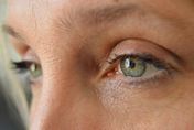 乾眼症不單是眼睛缺水 眼科醫師揭危險因子竟與皮膚疾病或長期服用特定藥物有關！