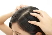 頭皮受傷了！中醫揭4大警訊：該調整洗髮頻率