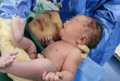 生出「鏡面寶寶」與新冠有關？上海長沙2醫院胎兒內臟反位增4倍