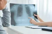 新癌王「肺癌」登10大癌症之首！最新「低劑量電腦斷層掃描」進行小結節篩檢