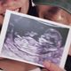夫妻倆生日當天爆喜訊！婁峻碩感性曝「焦凡凡懷孕了」