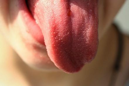 真要命！身體是否出問題從舌痛位置可知　中醫授4穴道舒緩舌痛
