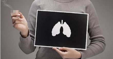 全家都中標！50歲婦慘罹「肺癌」　專家：每年幾乎奪去五萬多人性命！