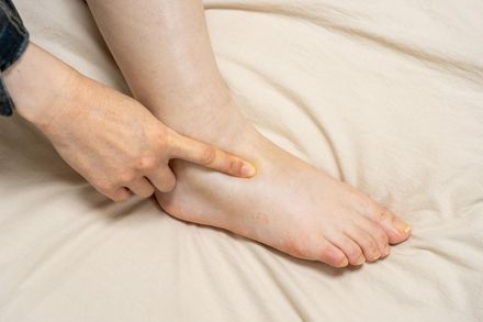 腳部水腫是腎臟出問題？ 醫：單腳、雙腳病因不同