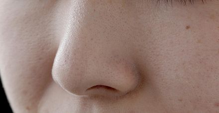 鼻塞、打呼都是「鼻中膈彎曲」警訊！醫曝「很多人有」嚴重恐致呼吸中止症