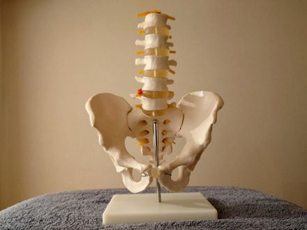 78歲老婦力抗大腸癌卻因背痛受挫　一檢查竟是骨鬆作祟