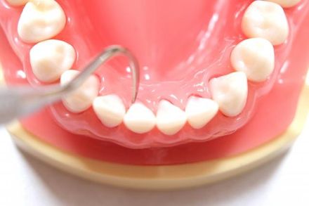 牙齦紅腫是因火氣大？ 牙醫揭2錯誤迷思　可能是牙周病徵兆！