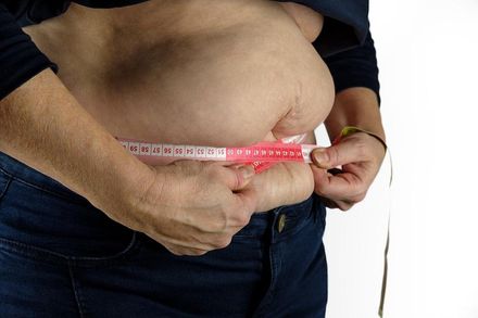 44歲男117公斤「內視鏡胃袖整形術」搭配飲食　1個月甩肉12KG