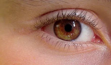 眼睛也會曬傷！夏季紫外線直入雙眼恐引發白內障　醫師建議護眼2策略