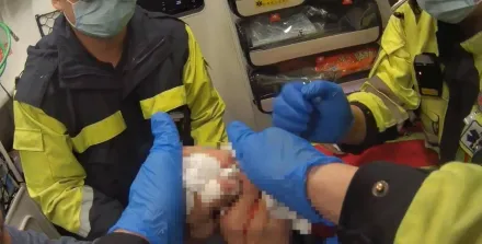 慎入！新北40歲木工鋸斷右食指血狂噴　消防撿指送醫搶救