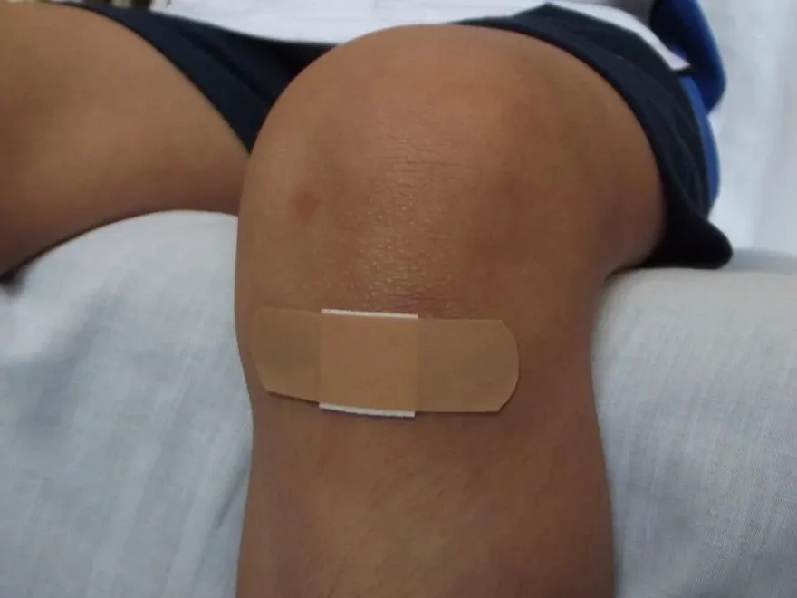 男童受傷感染「吃肉細菌」病逝！NHS警告：傷口出現10症狀馬上送醫