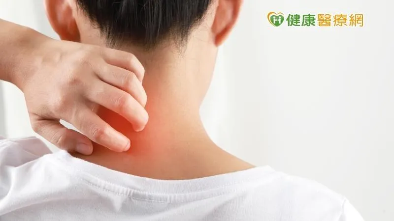 拚工作賠了健康！頸背發炎脫皮流血　連吞6顆類固醇都壓不住