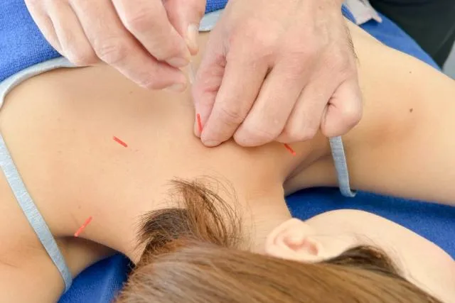 拔罐有禁忌　醫警「不是人人」都能做！