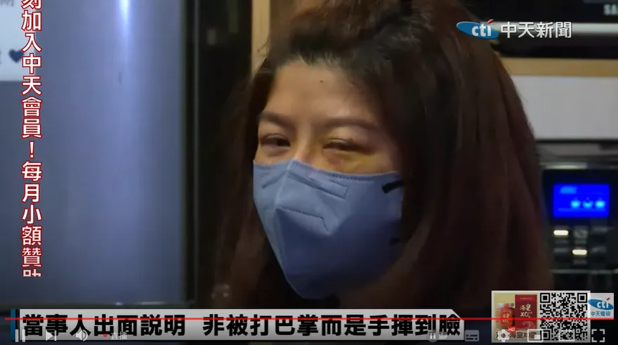 影/太玄宮執事自稱「被揮掉眼鏡」　臉上傷痕是被刮傷而非打傷