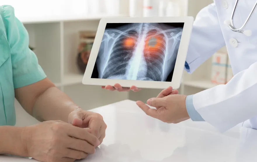 婦腰痛就醫檢查才知罹「肺癌末期」！一查驚見7手足「4人罹癌」