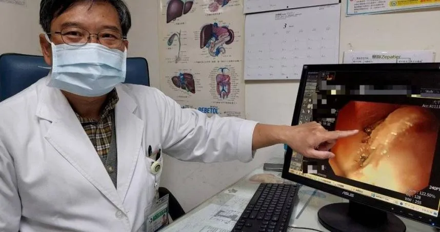 8旬翁出遊吃飽昏倒無呼吸心跳　醫一看傻眼「食道被塞滿」1小時才清完！