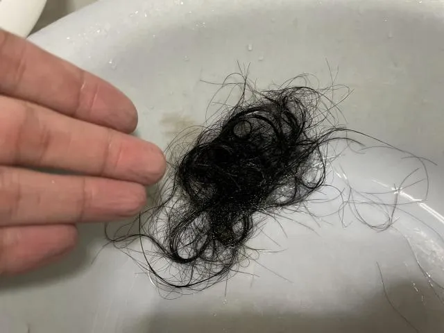 禿頭戴假髮不清潔　皮膚醫：恐加劇脫髮問題