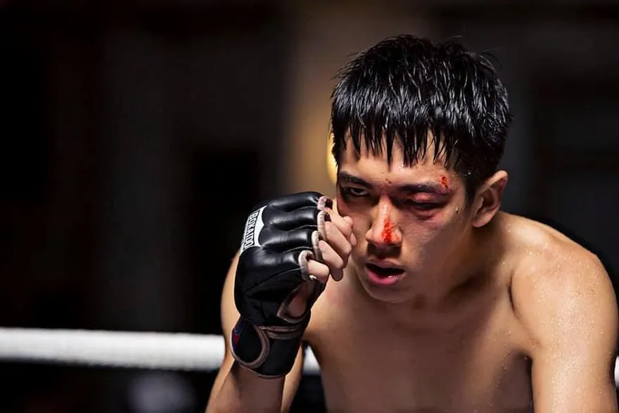 影/柯震東遭「指甲戳眼」右眼瞼縫7針　曝陌生人做1事留陰影