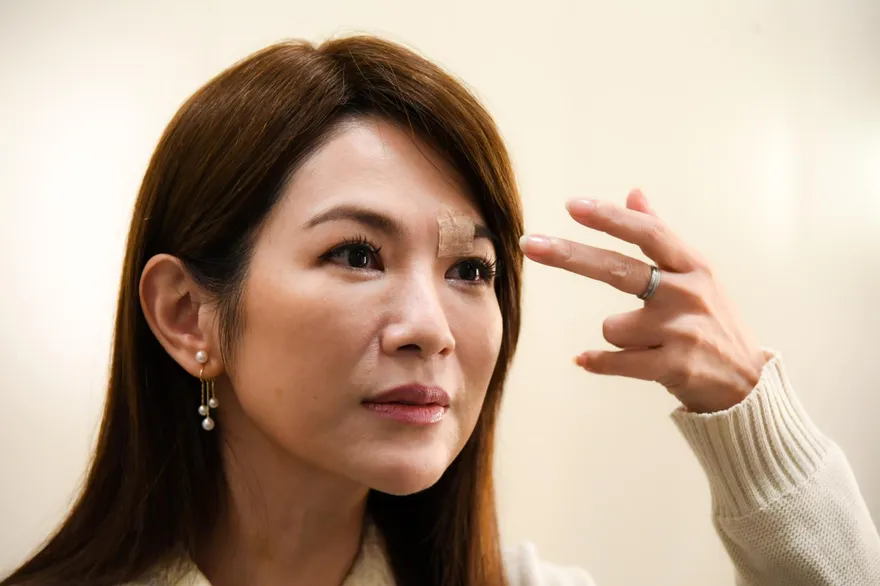 八點檔女星開拍前摔倒破相　「血狂流滴地」緊急送醫縫十多針...慘況曝光