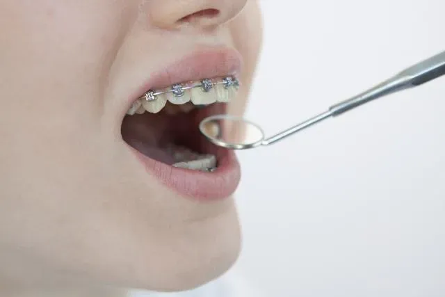 牙結石不清恐讓疾病找上身！醫曝「5情況」不僅有口臭還不美觀