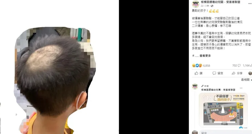 獨！採檢毛髮專家看到也嚇一跳!兒頭頂禿一塊惹怒家長 毛髮驗毒專家：通常只需剪0.2G-0.3G!