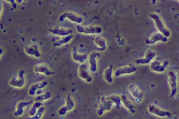 變形蟲食腦案匡列642人　專家：別過度恐慌　水質嚴重污染早不只1人發病！