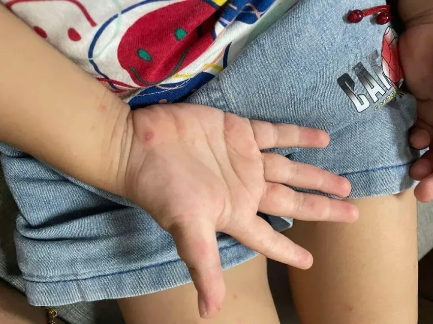 又爆腸病毒重症！　南部未滿1個月嫩嬰「6症狀齊發」進加護
