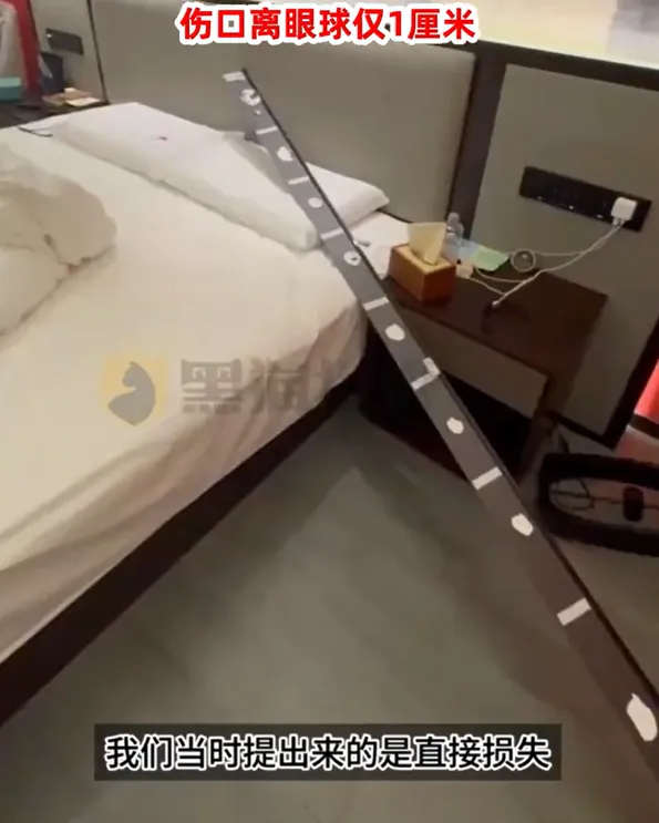 住高檔飯店半夜「天降金屬吊頂」砸破臉　陸男縫6針孕妻驚嚇