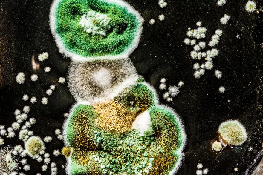 台灣本土首例！貨櫃清潔工染「球黴菌症」恐因國外污染塵土