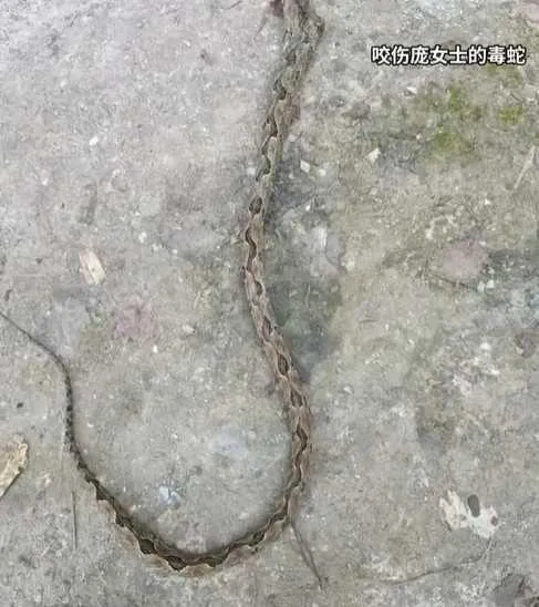 一條值4百萬！陸婦遭「全球最貴毒蛇」咬傷　醫曝嚴重後果