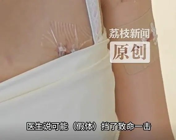 影/陸女遇劫遭狂刺20多刀…「隆乳填充物」竟為她擋刀救命