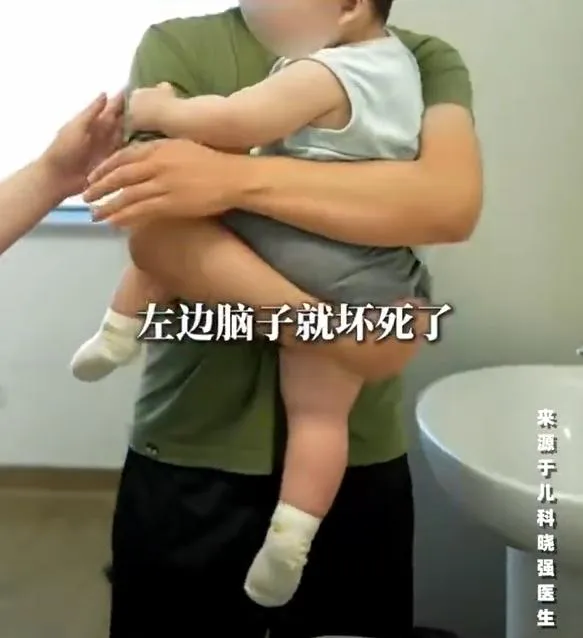 哄睡猛搖「晃到寶寶腦損傷」　陸新手爸懊嘆：1歲還不會爬