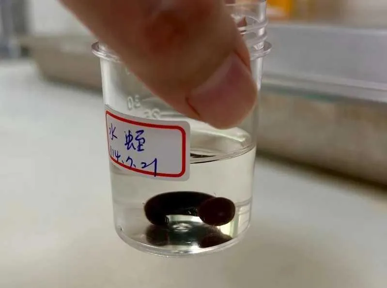 南投男子以為喉嚨有痰　檢查驚見藏4公分水蛭