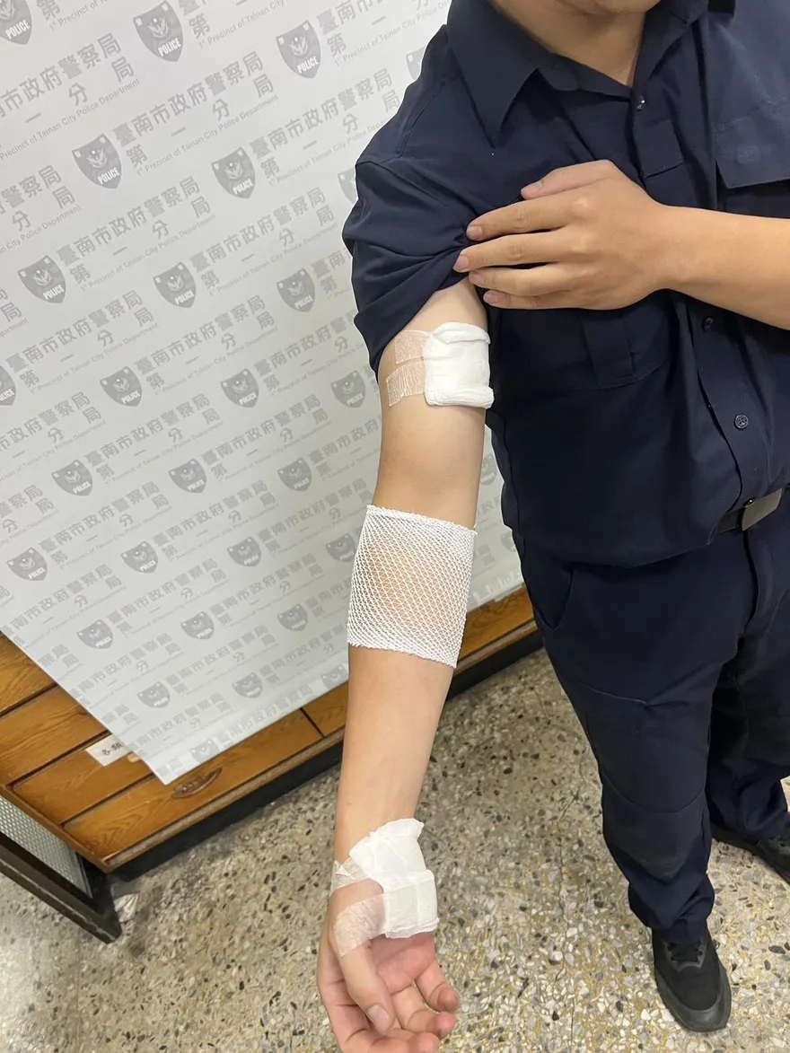台南所長追行車糾紛嫌犯　竟遭對方持榔頭攻擊、咬傷手臂