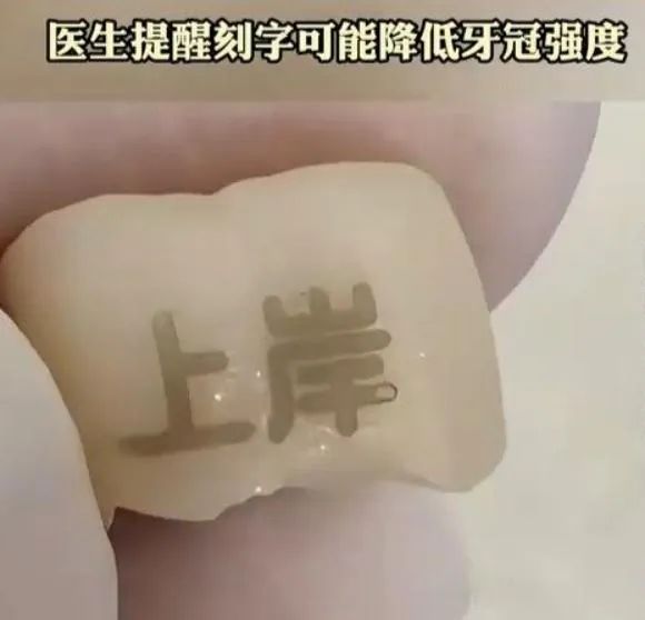 陸年輕人瘋「牙齒紋身」！「上岸、發財」人氣最旺