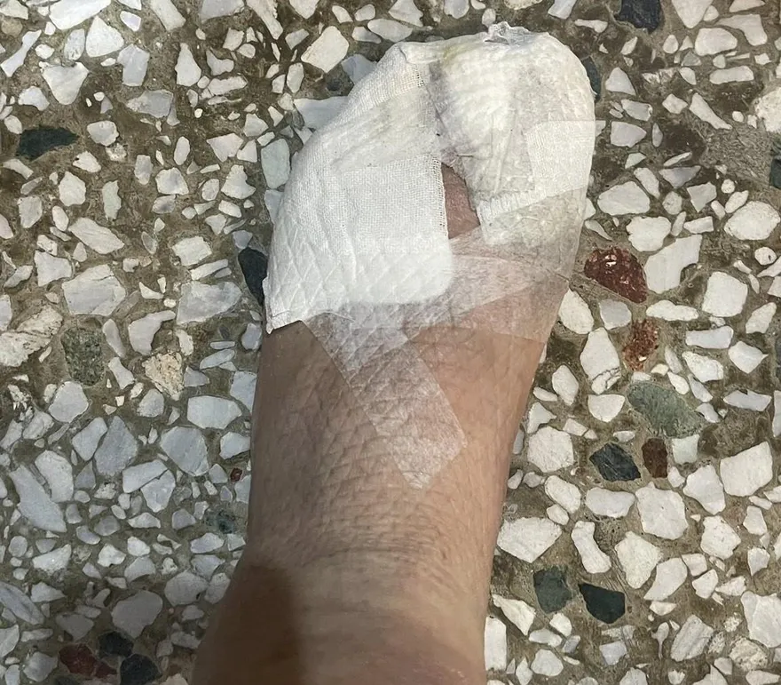 花蓮光復大安村長救災重傷　10腳趾「磨破皮快見骨」