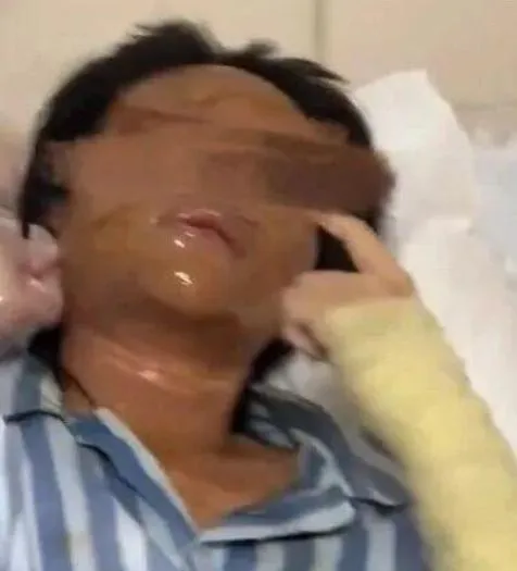 悚！陸美女主播家門口取包裹　竟是「包裹炸彈」慘炸毀容